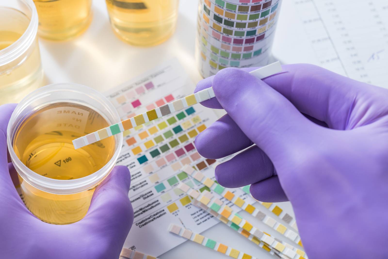 cbd drug test